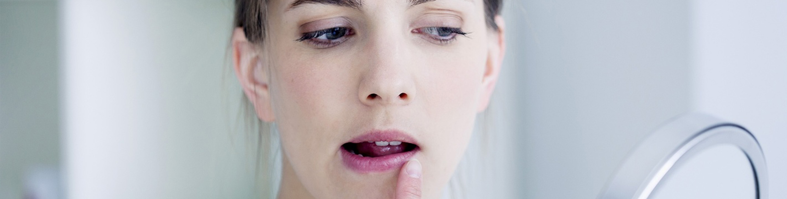 Imate pogosto herpes? Odkrijte načine, da ga naslednjič preprečite